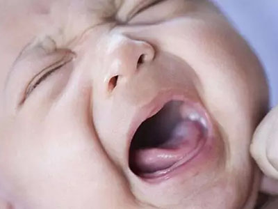 　　幼兒口腔潰瘍是經常發生的一種疾病，也稱為口瘡，幼兒發生口腔潰瘍的原因比較復雜，主要是由於免疫力降低或者是體內缺乏某一種維生素以及上火等原因綜合引起的。幼兒患上口腔潰瘍之後，心情煩躁，會因為疼痛而難以咀嚼，發生哭鬧的情形，媽媽們也會很擔心。幼兒口腔潰瘍怎麼辦呢？一般情況下可以用些簡單的辦法加以緩解和治療。  　　幼兒口腔潰瘍維生素C來幫忙  　　如果幼兒發生口腔潰瘍了，媽媽們在擔心和心疼之中也別忘了及時尋找解決的辦法，有時候一些小辦法針對口腔潰瘍是很有好處的。維生素C具有消炎鎮痛的作用，把維生素C片含在潰瘍的部位，每天含一次，連續3天左右就會慢慢會好轉了。這種辦法比較簡單，只需要普通的維生素C片就好。如果身邊沒有維生素C，還可以用西瓜皮打成汁含在嘴裡的辦法，西瓜皮具有清熱下火的功效，用來治療口腔潰瘍是很有好處的。這樣連續幾次也是會有效果的。  　　幼兒口腔潰瘍喝全脂奶粉  　　這種辦法既可以緩解潰瘍，又可以為孩子適當補充身體營養，是很好的方法，具體的做法是，用全脂奶粉，每次1湯韪並加少許白糖，用開水沖服，每天2-3次，臨睡前沖服效果最佳。通常服用2天後潰瘍即可消失。這種辦法是很簡單的，但是效果也是很好的。  　　如果您的寶寶出現了口腔潰瘍的症狀之後您不要心急，試試這些辦法緩解和治療疾病，還可以使孩子免受<a name='InnerLinkKeyWord' href='http://www.jianke.com/news/bj/jkyy/' _fcksavedurl='http://www.jianke.com/news/bj/jkyy/' target='_blank'>吃藥</a>打針之苦。