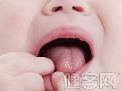 口腔經常潰瘍該如何治療