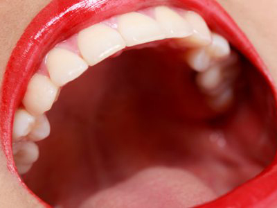 牙痛怎麼辦？治療牙痛的偏方