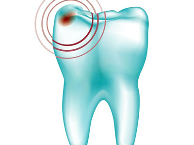 牙疼誤區，你是否知道該如何預防牙痛呢？