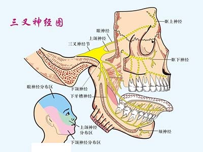 勿將三叉神經痛當牙痛