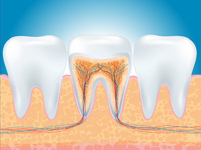 牙痛難忍怎麼辦？