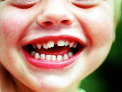 　　牙痛常見的有四種情況：  　　1、外傷  　　孩子意外摔倒碰傷牙齒是常有的事，有時則是進食時咬到砂石骨頭，使牙齒出現創傷性根尖周炎引起疼痛。如果牙僅是有點松動只需吃點消炎藥，軟食幾天讓患牙休息一周即可；如牙已摔斷，就需請醫生在麻醉下抽出暴露的牙神經後補牙或拔牙。  　　2、齲洞  　　不吃飯不牙痛，一吃飯就牙痛，尤其吃冷吃熱時疼痛加重。這一般是牙齒上有深齲洞了，必須去口腔科進行治療。洞淺些的補好就行，重者需將牙神經失活後再補牙  　　3、牙髓神經發炎  　　是牙痛呈現無誘因的陣發性劇痛。孩子即使不吃東西時也一陣陣地哭鬧，常常感到整個一邊牙都痛，指不出哪一個具體的牙痛來，夜間時加重，往往一夜哭鬧不肯躺下，這是典型的牙髓神經發炎。  　　遇到這種情況，任何止痛藥都難以奏效，只有馬上帶孩子到口腔科讓醫生用牙鑽把牙磨開，放上一點消炎止痛藥就會手到病除立即止痛。不過這樣的牙不痛後還要失活補牙，需多次就診治療。  　　4、牙根尖周圍發炎  　　患兒的牙齒持續疼痛。如不治療一天天逐漸加重，同時出現牙齲紅腫，牙齒浮動，重者臉也腫了，颌下淋巴結也腫大，出現發燒症狀，這是牙根尖周圍發炎，有時發展成化膿性炎症。這樣就必須請醫生將患牙磨開將膿液引出來，口服或肌注抗菌素，還要反復換藥直至炎症徹底消除才能最後補牙。  　　4、牙根尖周圍發炎  　　患兒的牙齒持續疼痛。如不治療一天天逐漸加重，同時出現牙齲紅腫，牙齒浮動，重者臉也腫了，颌下淋巴結也腫大，出現發燒症狀，這是牙根尖周圍發炎，有時發展成化膿性炎症。這樣就必須請醫生將患牙磨開將膿液引出來，口服或肌注抗菌素，還要反復換藥直至炎症徹底消除才能最後補牙。