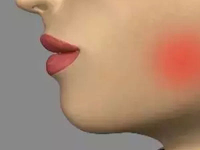 很多情況都可能引起牙痛，怎樣治療取決於牙痛的病因。如果出現了牙痛，請及時就醫。牙醫會采取措施緩解疼痛，然後通過全面的口腔檢查診斷牙痛原因。牙齒治療和修復等可確保解決牙痛問題。