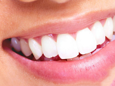 蛀牙不治後果嚴重，你對蛀牙的了解有多少？