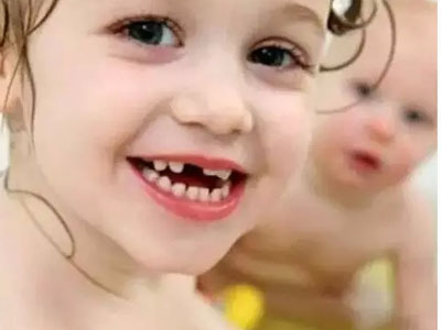 為什麼你的孩子容易“蛀牙”？