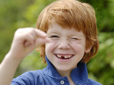 小孩齲齒治療方法？