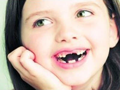 蛀牙怎麼預防蛀牙預防吃什麼？