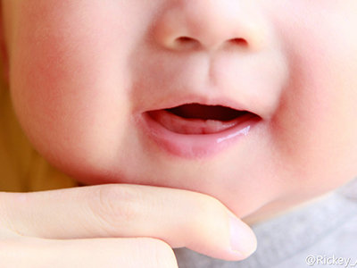 兒童“蛀牙”要治更要防