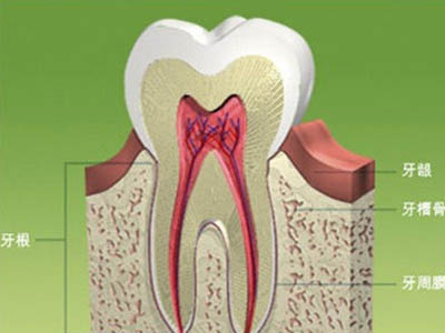 你有蛀牙嗎？齲齒可引發全身疾病