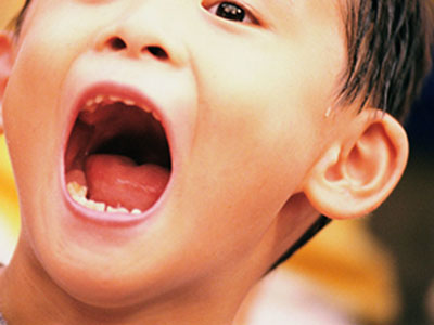 中國5歲兒童乳牙患齲率為66% 世界上處較高水平