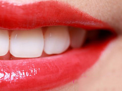 什麼是齲齒？齲齒的病因與症狀？