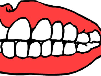 乳牙齲壞究竟應該補還是拔？