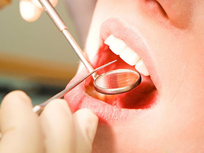 牙齒疼痛最常見齲齒