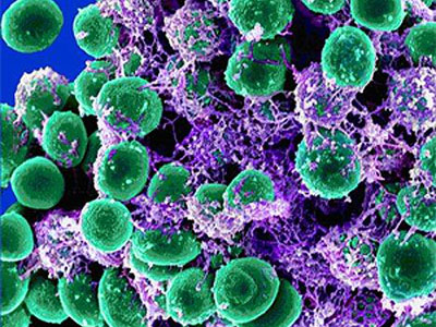 近日，中國科學院青島生物能源與過程研究所單細胞研究中心與中山大學光華口腔醫學院的合作團隊，示范了一種基於人體共生菌群的疾病風險評估與預警策略。相關成果在線發表於CellHost&Microbe(Teng,etal,CellHost&Microbe,2015)。