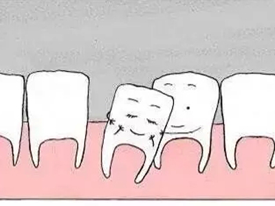 牙齒松動紅腫竟是牙龈癌在發威！