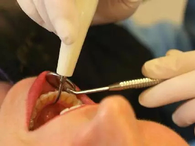 這些症狀可能是牙龈癌早期預兆！