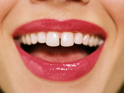 什麼樣的症狀出現需要警惕牙龈癌?