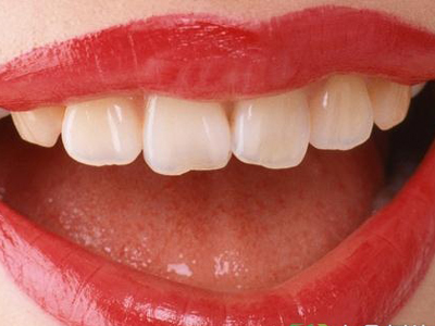 牙龈癌預防措施有哪些