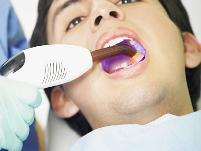 牙龈也會發生癌症？口腔癌的三級預防原則