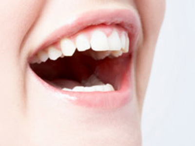 唇裂修復後飲食方面需要如何護理？