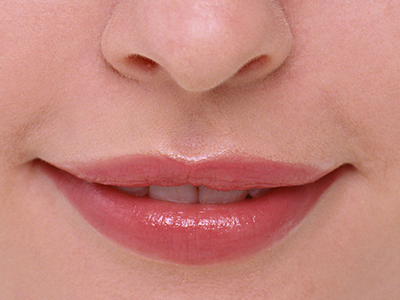 　唇炎的症狀主要有哪些