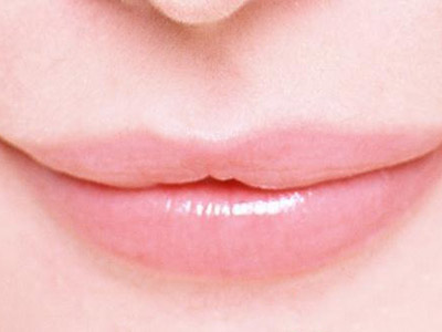 預防唇腭裂孕期前三月最關鍵