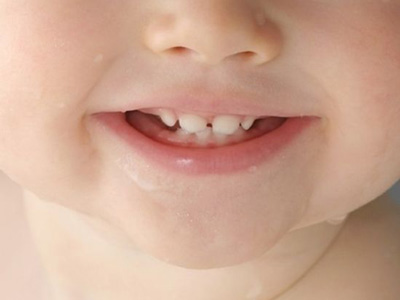 寶寶出牙疼痛可以使用止疼膏嗎