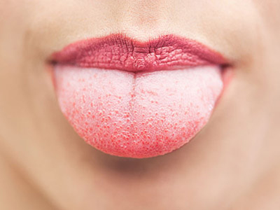 清洗舌頭——遠離口腔疾病