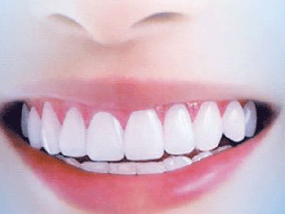 牙齒缺失的危害有哪些