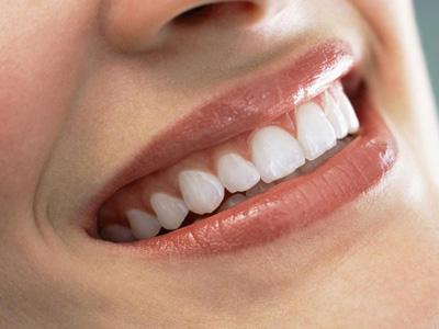 種植牙齒壽命是多久？如何預防口腔病症