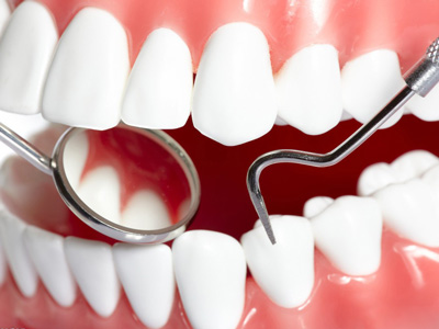 種植牙齒壽命是多久？如何預防口腔病症
