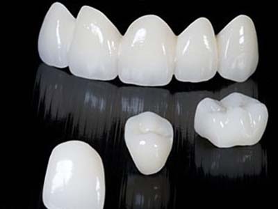 口腔護理對全冠修復後牙周健康的影響