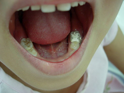 想要孩子牙齒好，你需要知道這十個問題