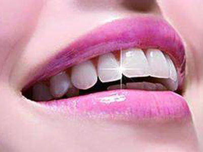 牙齒什麼顏色最健康？白得閃耀並不是一定最好！
