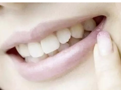 人到底有多少顆牙？正常人牙齒數量在28-32之間~
