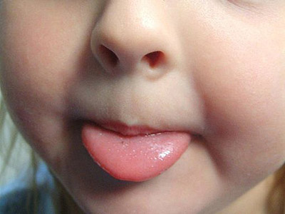 你給孩子吃對了嗎？ ——食物對孩子口腔發育的重要性