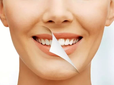 口腔小常識-牙周炎是什麼？