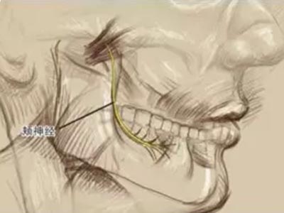 牙拔除術所致颏神經、頰神經及鼻腭神經損傷的預防與處理