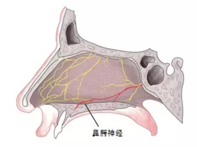 牙拔除術所致颏神經、頰神經及鼻腭神經損傷的預防與處理