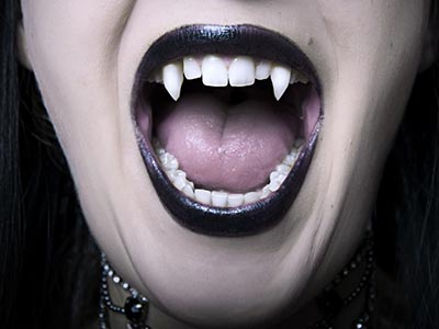 英國婦女罹患牙周病 4年後長僚牙變“吸血鬼”