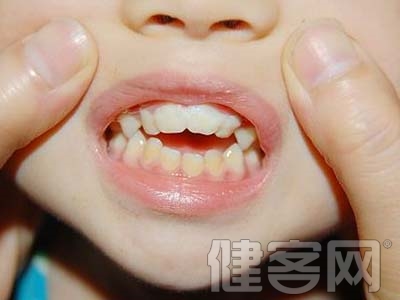 　　孩子替牙時長"雙排牙"怎麼辦?