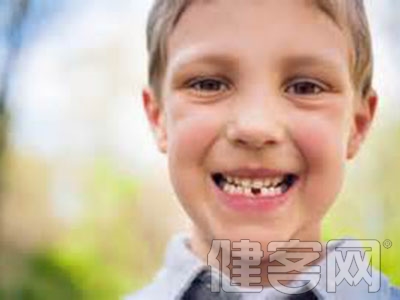 　　多生牙又名額外牙，是恆牙中額外多出的牙齒，其數目可為1～2或3～4個不等。形狀多呈圓柱形或圓錐形，也有近似正常牙形者。多生牙發生於牙弓的任何部位，但大多數位於上中切牙之間或在其腭側。它先於上中切牙萌出，故而影響了恆牙的正常排列。有的額外牙埋藏在上颌骨中而不萌出。萌出者應及早拔除，空余的間隙需關閉。上中切牙區的額外牙，若在中切牙未萌出前拔除，一般可以防止上中切牙錯位。否則將萌出在中切牙之間或腭側，造成前牙擁擠、上中切牙向唇移位畸形或中切牙間有較寬間隙等。額外牙拔除後，如不能自行關閉間隙，可用活動矯治器幫助其關閉。