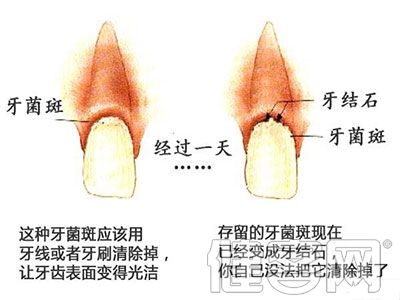 這些年 你的刷牙方法可能是錯的