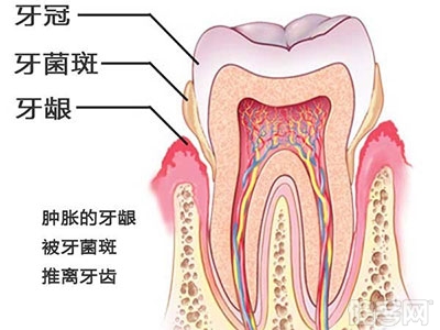 這些年 你的刷牙方法可能是錯的