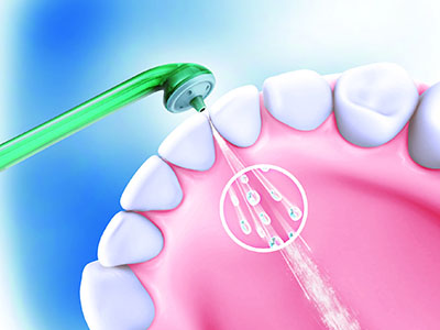 　口腔衛生與牙周病的關系