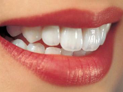 怎樣判斷自己是否有牙結石？