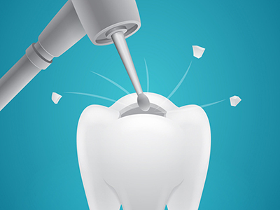 　牙龈炎洗牙能治療嗎？