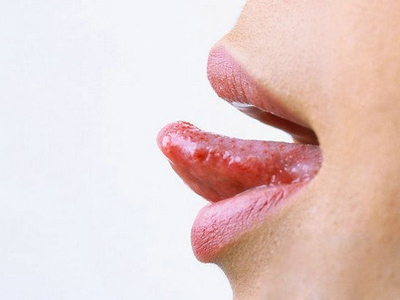 經常咬舌頭可能是“神經病”
