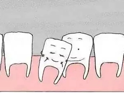 洗牙有好處 同樣也有壞處